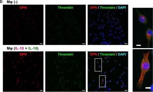 Detection of Mouse Osteopontin/OPN by Immunocytochemistry/Immunofluorescence