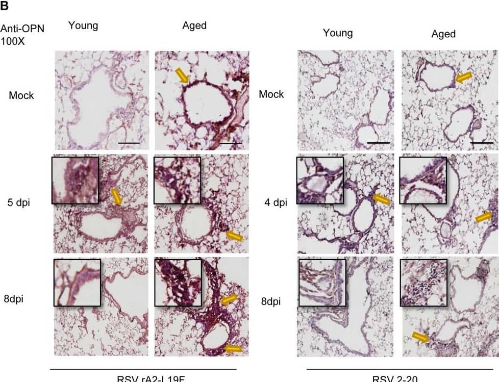 Detection of Osteopontin/OPN by Immunohistochemistry