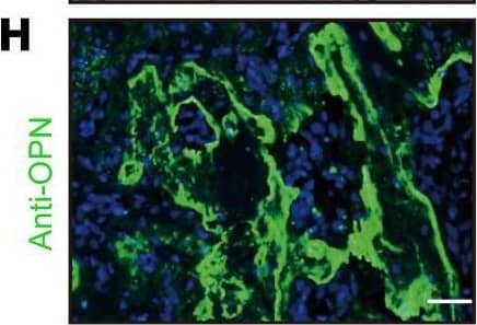 Detection of Osteopontin/OPN by Immunohistochemistry