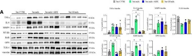Detection of Osteopontin/OPN by Western Blot