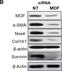 Detection of Nox4 by Western Blot