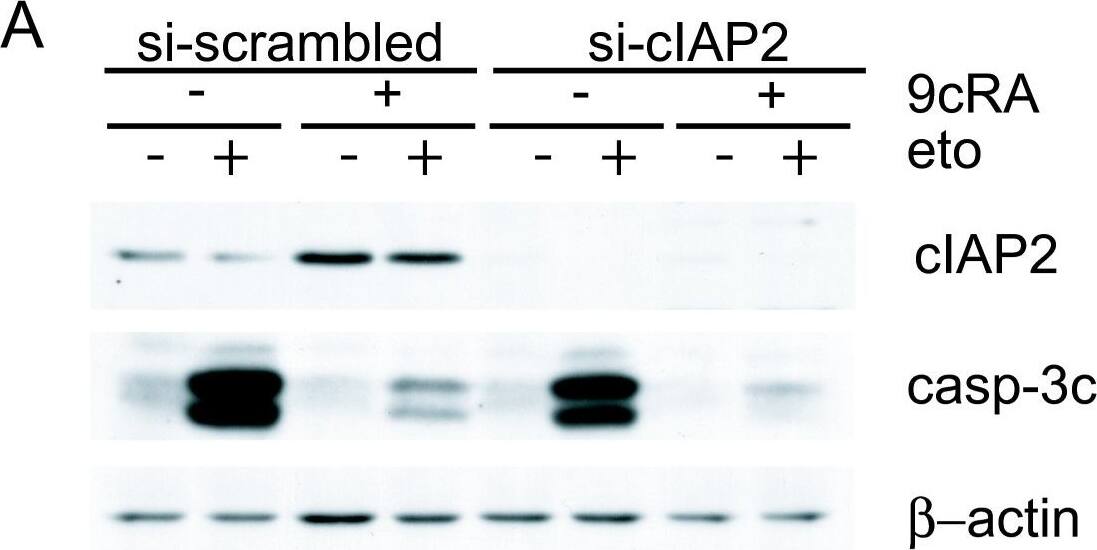 Detection of Human cIAP-2/HIAP-1 by Western Blot