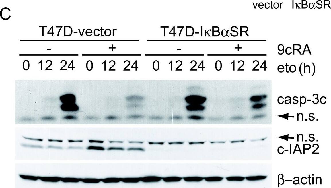 Detection of Human cIAP-2/HIAP-1 by Western Blot