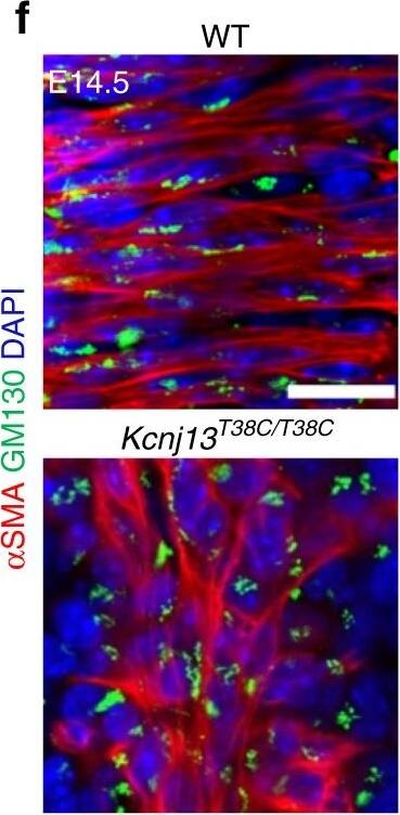Detection of Mouse GM130/GOLGA2 by Immunocytochemistry/Immunofluorescence
