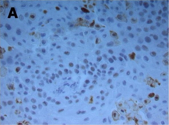 Detection of Mouse Caspase-3 by Immunohistochemistry