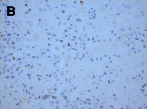 Detection of Mouse Caspase-3 by Immunohistochemistry