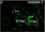 Detection of Human Caspase-3 by Immunocytochemistry/Immunofluorescence