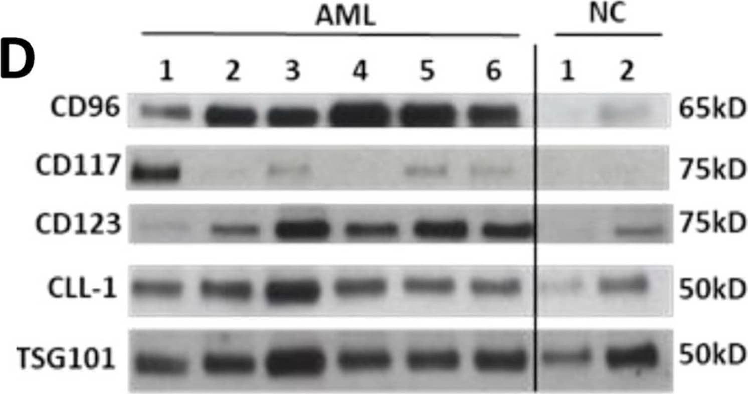 Detection of Human IL-3R alpha/CD123 by Western Blot