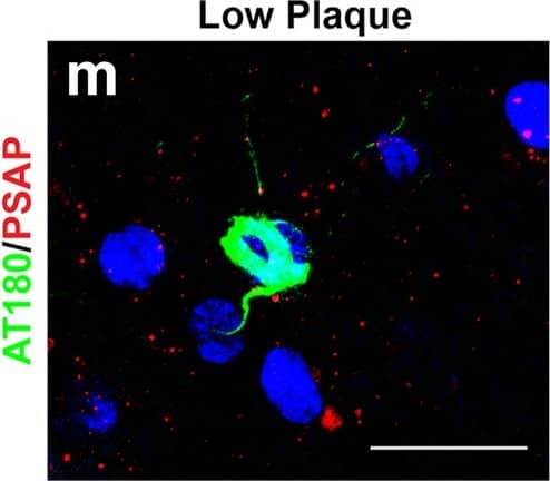 Detection of Human PSAP by Immunocytochemistry/Immunofluorescence