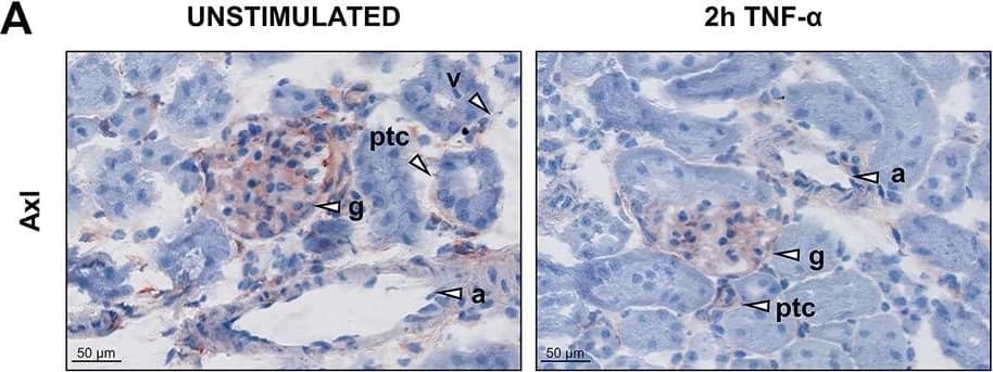Detection of Mouse Axl by Immunohistochemistry