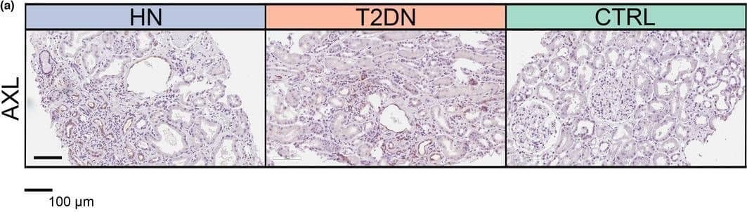 Detection of Axl by Immunohistochemistry