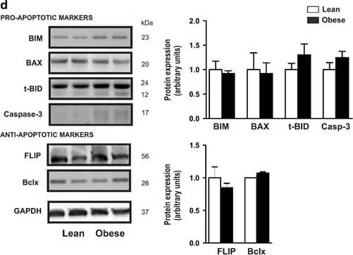 Detection of Human BID by Western Blot