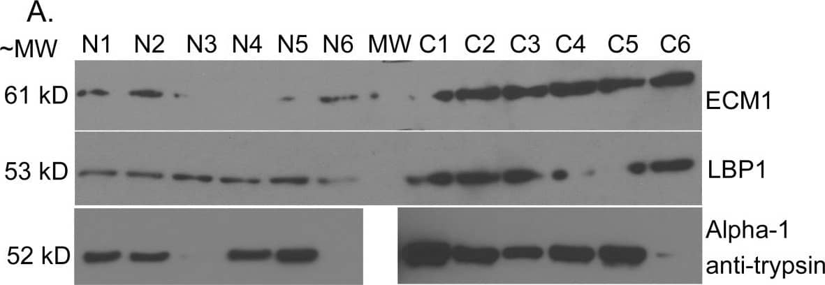 Detection of Human LBP by Western Blot