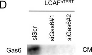 Detection of Human Gas6 by Western Blot