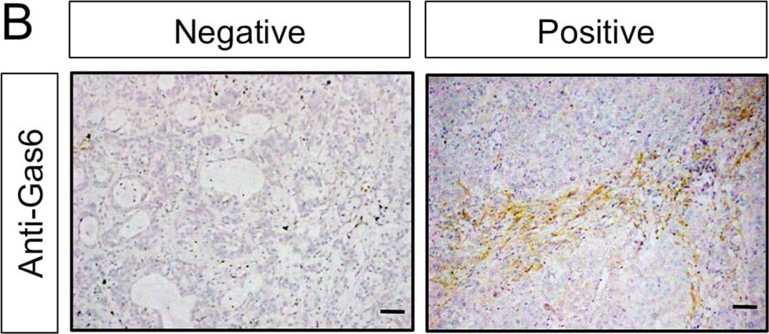 Detection of Human Gas6 by Immunohistochemistry