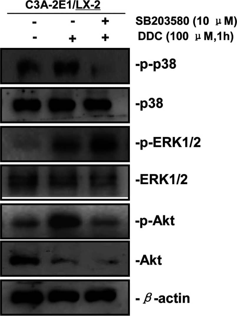 Detection of Human AKT by Western Blot