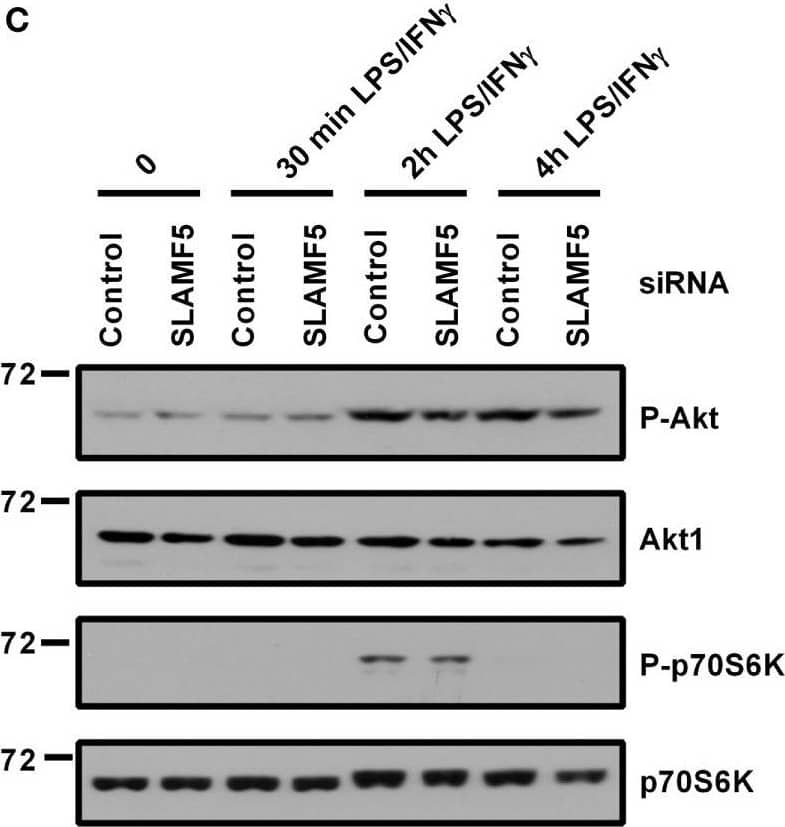 Detection of Human AKT by Western Blot