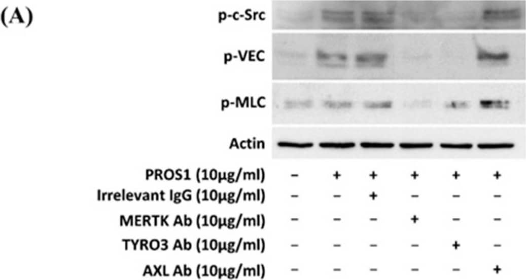 Detection of Human Mer by Western Blot