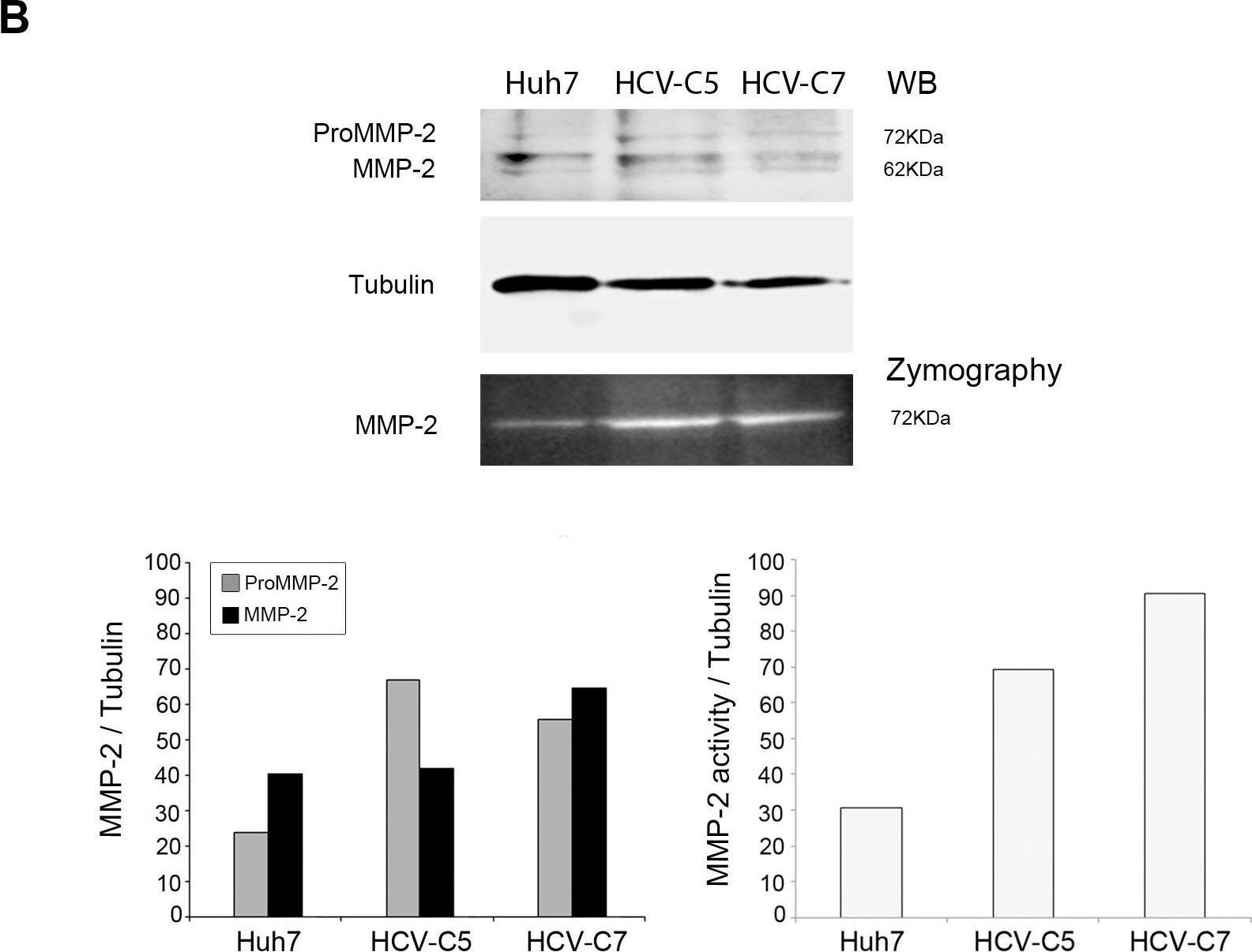 Detection of Human MMP-2 by Western Blot