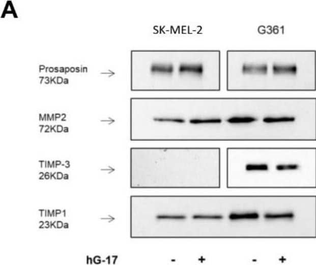 Detection of MMP-2 by Western Blot