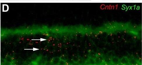 Detection of Contactin-1 by Immunohistochemistry
