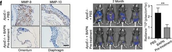 Detection of Mouse MMP-9 by Immunohistochemistry