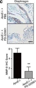 Detection of Mouse MMP-9 by Immunohistochemistry
