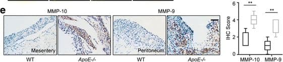 Detection of Mouse MMP-9 by Immunohistochemistry