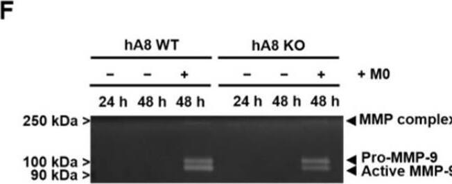 Detection of Human MMP-9 by Western Blot