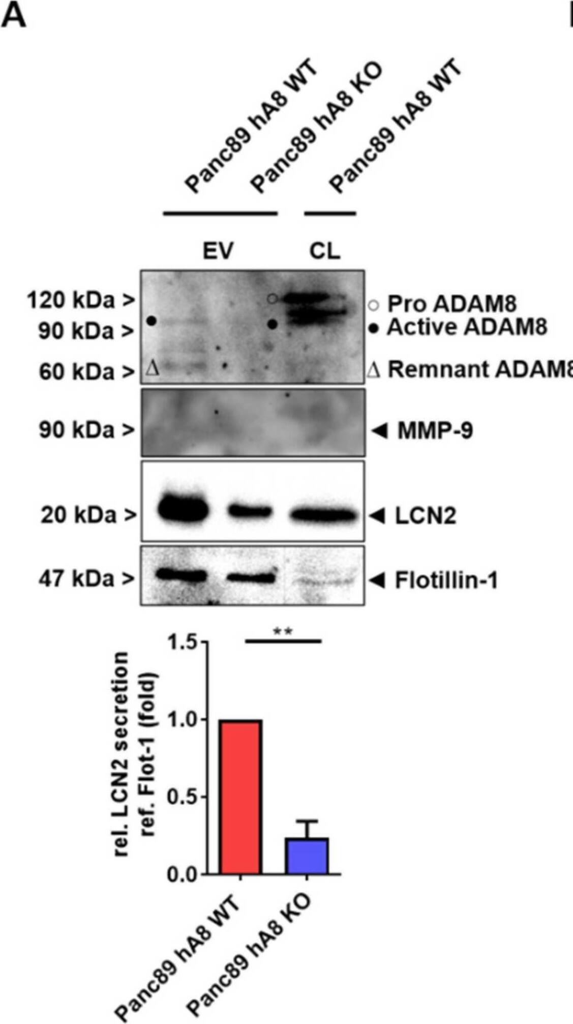 Detection of Human MMP-9 by Western Blot