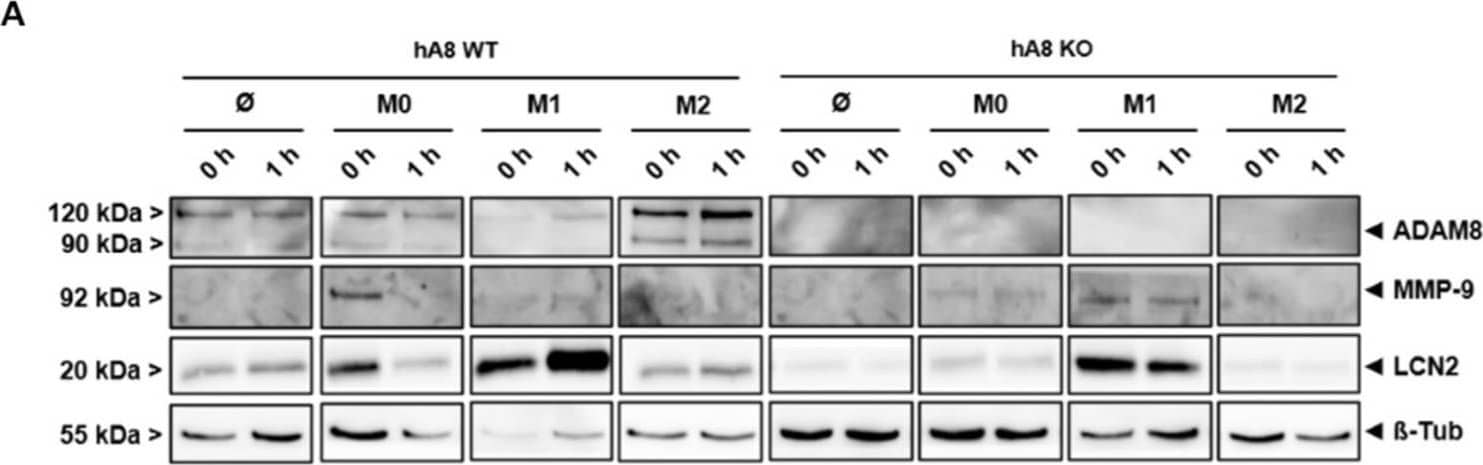 Detection of Human MMP-9 by Western Blot
