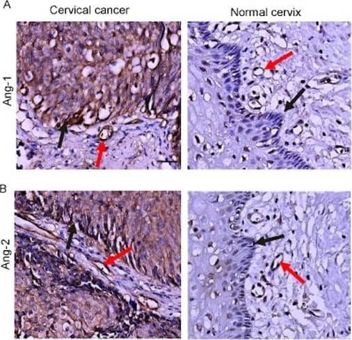 Detection of Human Angiopoietin-1 by Immunohistochemistry