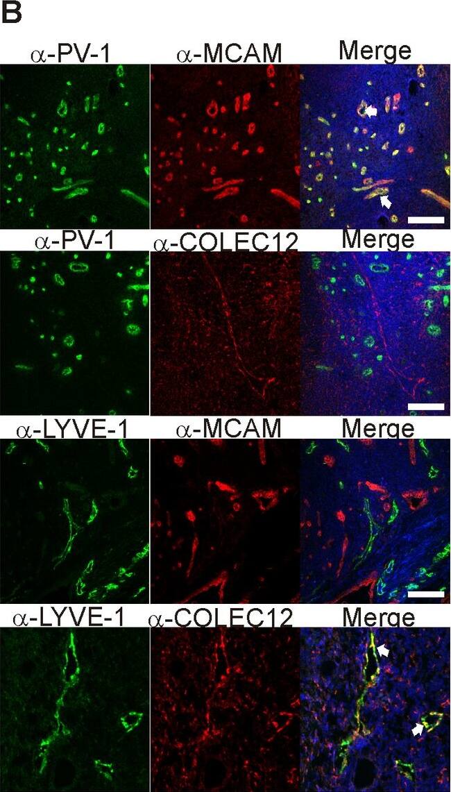 Detection of Human MCAM/CD146 by Immunocytochemistry/ Immunofluorescence