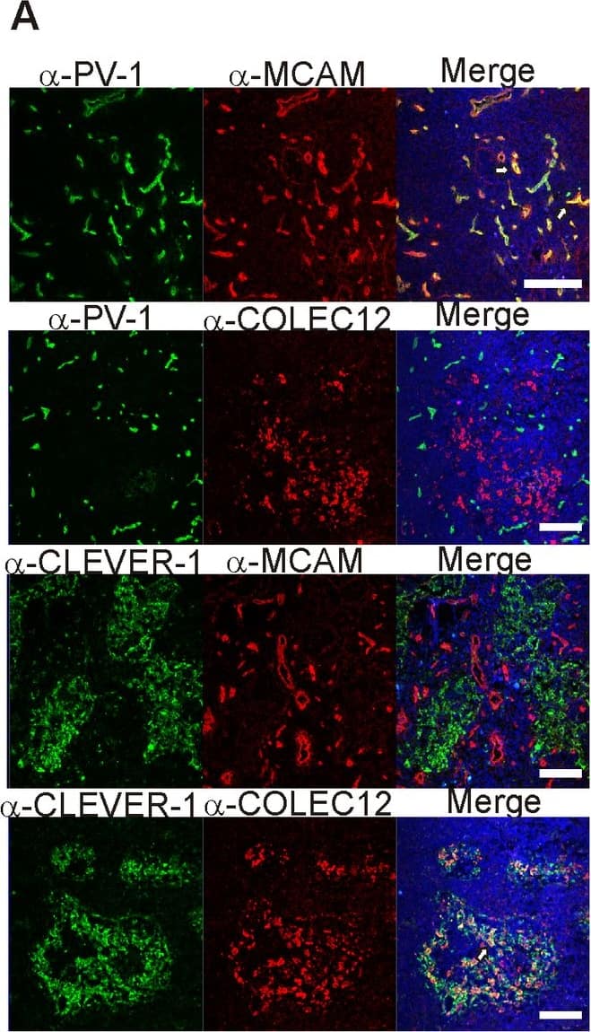 Detection of Human MCAM/CD146 by Immunocytochemistry/ Immunofluorescence