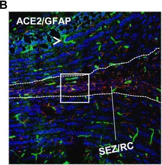 Detection of Mouse ACE-2 by Immunohistochemistry
