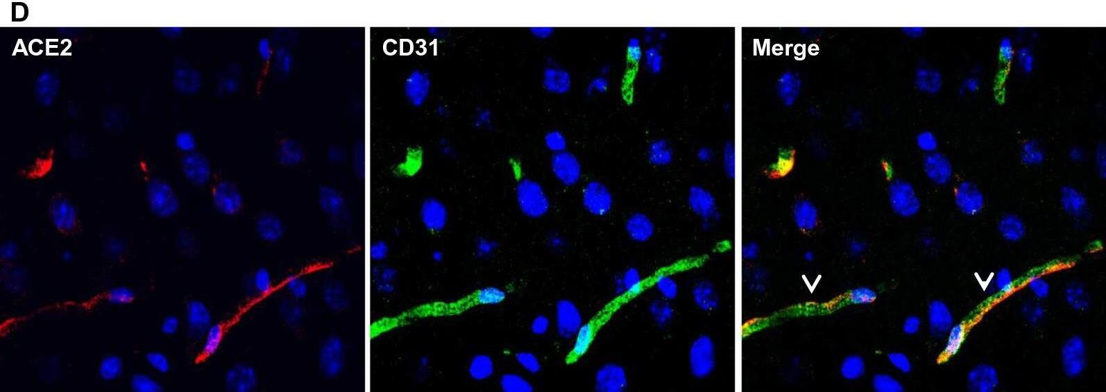 Detection of Mouse ACE-2 by Immunohistochemistry