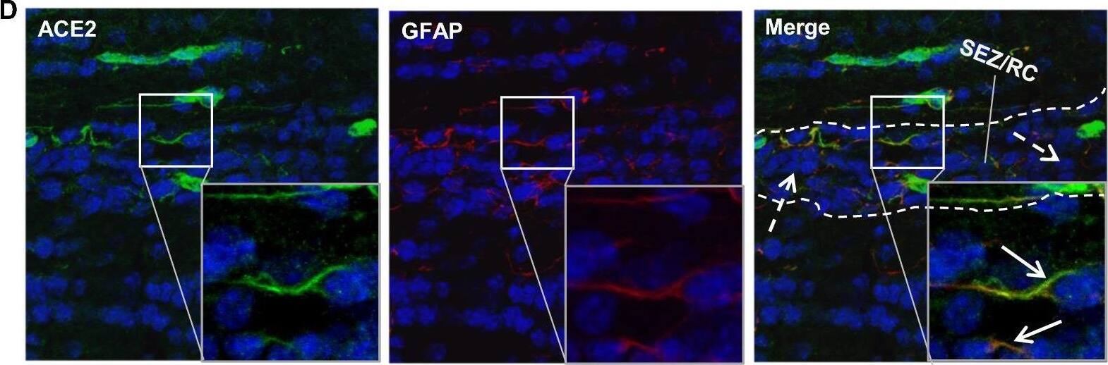 Detection of Mouse ACE-2 by Immunohistochemistry