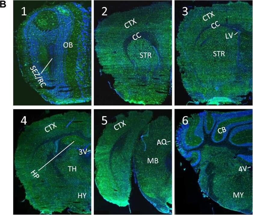 Detection of Mouse ACE-2 by Immunohistochemistry
