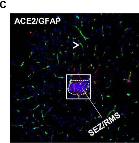Detection of Mouse ACE-2 by Immunohistochemistry