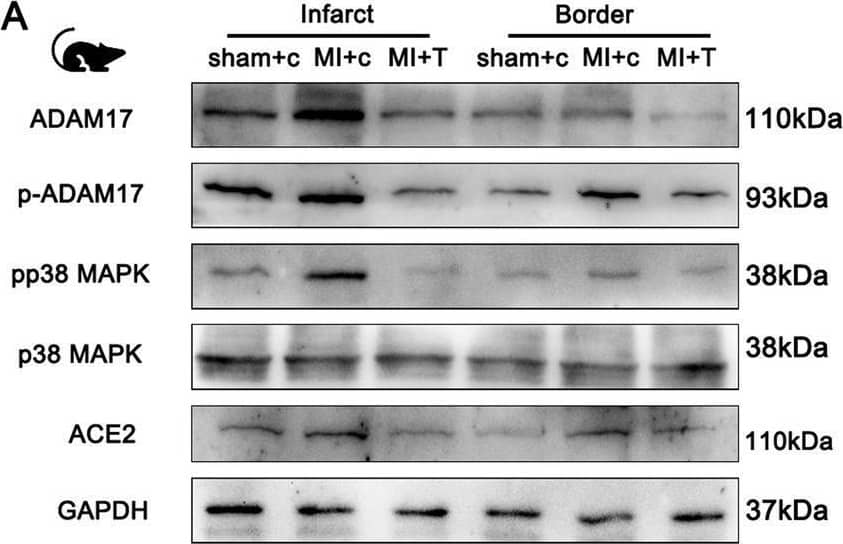 Detection of ACE-2 by Western Blot