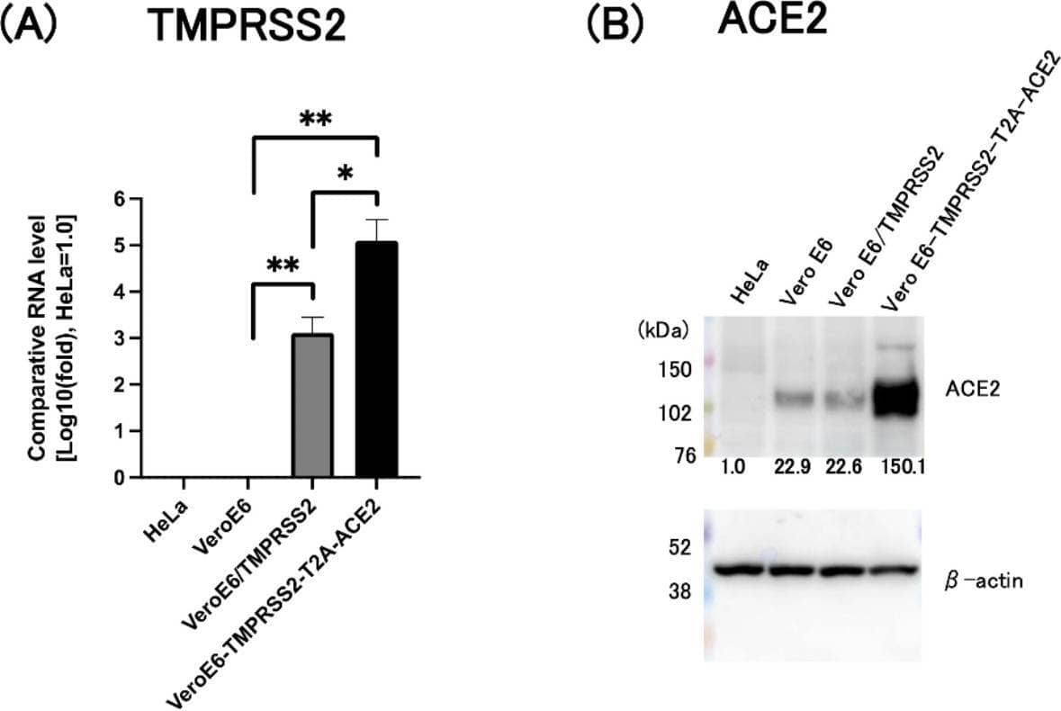 Detection of ACE-2 by Western Blot