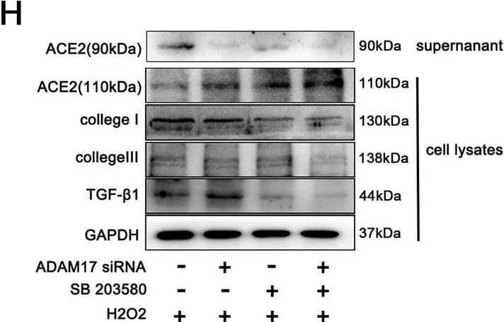 Detection of ACE-2 by Western Blot