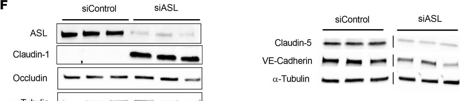 Detection of VE-Cadherin by Western Blot