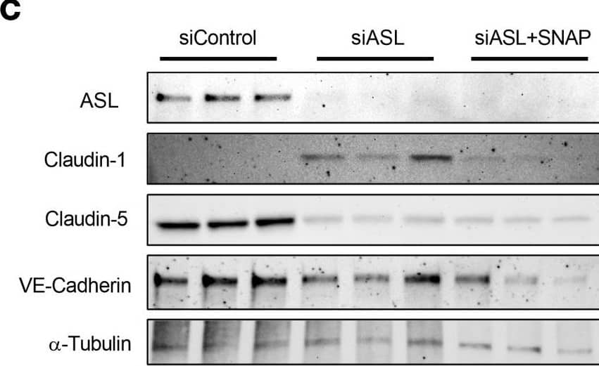 Detection of VE-Cadherin by Western Blot