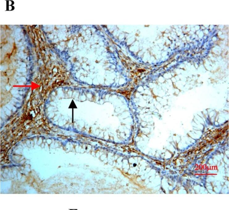 Detection of Human SPARC by Immunocytochemistry/ Immunofluorescence
