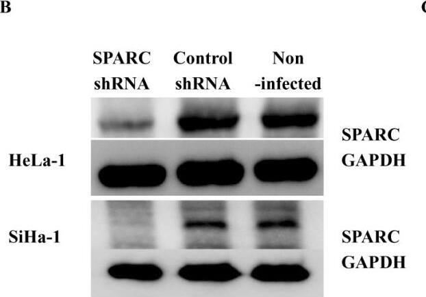 Detection of Human SPARC by Western Blot