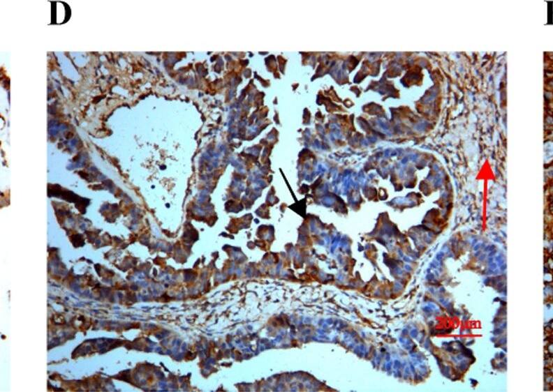 Detection of Human SPARC by Immunocytochemistry/ Immunofluorescence