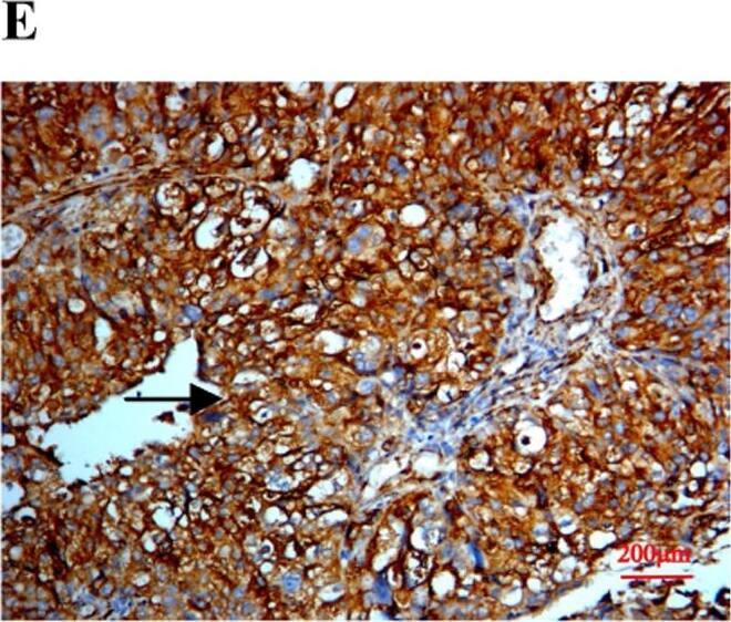 Detection of Human SPARC by Immunocytochemistry/ Immunofluorescence