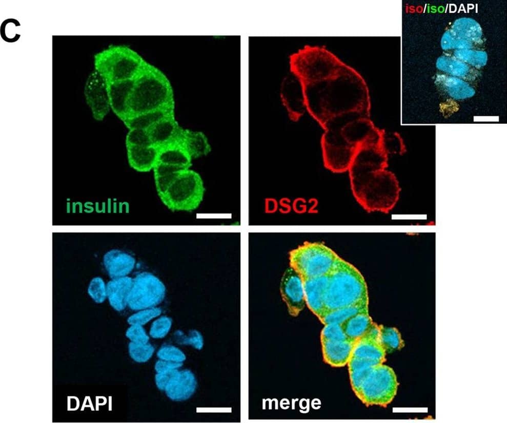 Detection of Desmoglein-2 by Immunocytochemistry/ Immunofluorescence