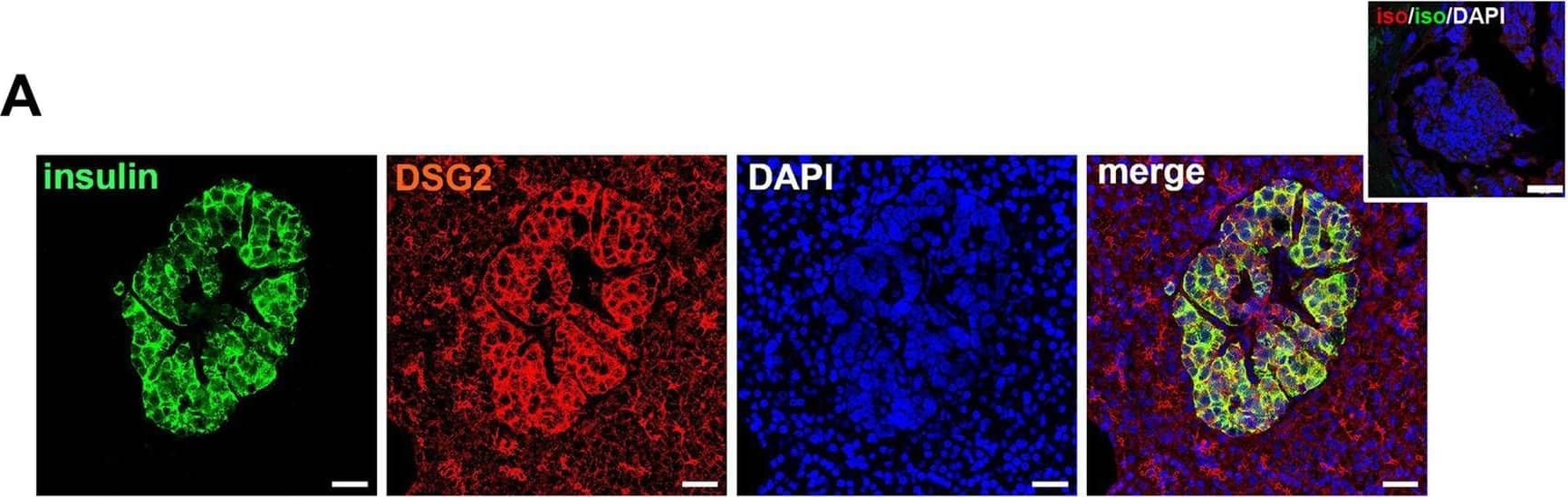 Detection of Desmoglein-2 by Immunohistochemistry